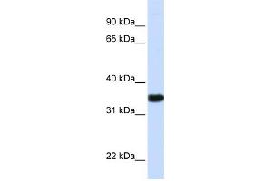 WB Suggested Anti-GAPDH Antibody Titration:  0. (GAPDH antibody  (N-Term))