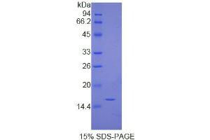 SDS-PAGE analysis of Human Immunoglobulin G4 Protein. (IgG4 Protein)