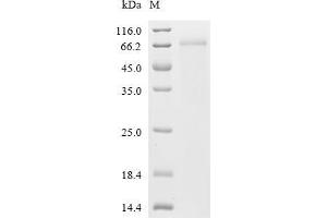 Zinc Finger Protein, Y-Linked (ZFY) (AA 1-409) protein (His tag)
