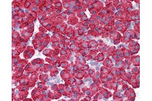 Anti-MDA5 antibody IHC of human pancreas. (IFIH1 antibody  (C-Term))