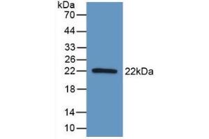 Detection of Recombinant AATK, Human using Polyclonal Antibody to Apoptosis Associated Tyrosine Kinase (AATK) (AATK antibody  (AA 1216-1374))