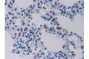 IHC-P analysis of Mouse Lung Tissue, with DAB staining. (CHI3L1 antibody  (AA 112-356))