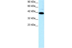 WB Suggested Anti-ZFP1 Antibody Titration: 0. (Zfp-1 antibody  (N-Term))