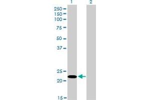 Western Blotting (WB) image for anti-serine/arginine-Rich Splicing Factor 10 (SRSF10) (AA 1-101) antibody (ABIN599153) (SRSF10 antibody  (AA 1-101))