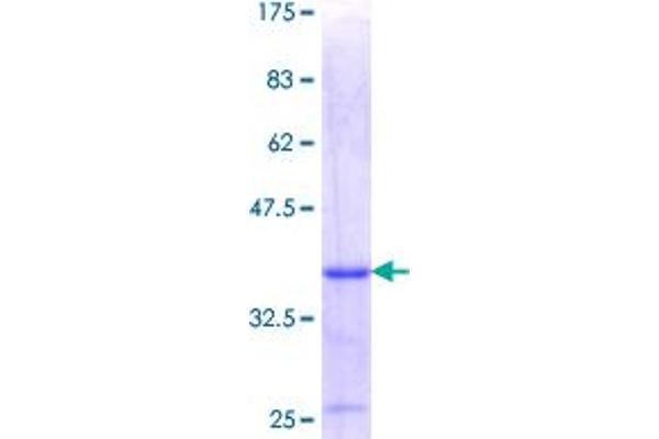 LIMS1 Protein (AA 226-325) (GST tag)