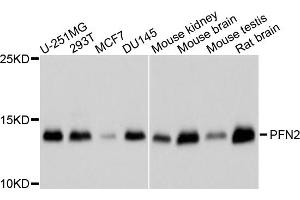 Western blot analysis of extracts of various cell lines, using PFN2 antibody (ABIN5995368) at 1/1000 dilution.