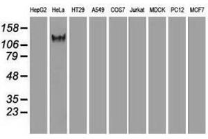 Image no. 6 for anti-L1 Cell Adhesion Molecule (L1CAM) antibody (ABIN1499089) (L1CAM antibody)