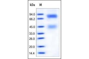 Human HGF R, His Tag on SDS-PAGE under reducing (R) condition.