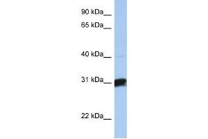 B3GALT6 antibody used at 1 ug/ml to detect target protein. (B3GALT6 antibody  (C-Term))