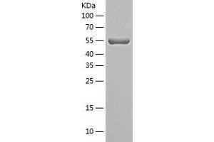 Western Blotting (WB) image for Syntrophin, alpha 1 (Dystrophin-Associated Protein A1, 59kDa, Acidic Component) (SNTA1) (AA 1-505) protein (His tag) (ABIN7125297) (SNTA1 Protein (AA 1-505) (His tag))