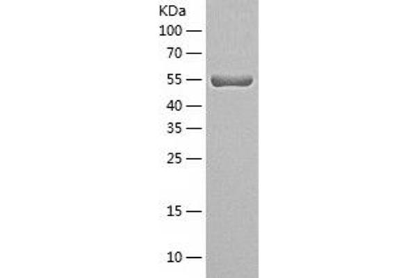 SNTA1 Protein (AA 1-505) (His tag)