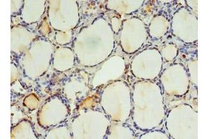 Immunohistochemistry of paraffin-embedded human thyroid tissue using ABIN7151410 at dilution of 1:100 (KIAA0494 antibody  (AA 1-483))