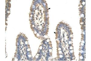 ANAPC7 antibody was used for immunohistochemistry at a concentration of 4-8 ug/ml to stain Epithelial cells of intestinal villus (arrows) in Human Intestine.