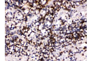Anti- CD22 Picoband antibody, IHC(P) IHC(P): Human Tonsil Tissue (CD22 antibody  (C-Term))