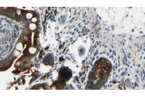 ABIN6269178 at 1/100 staining Mouse intestine tissue by IHC-P.