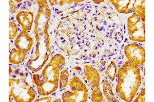 Immunohistochemistry of paraffin-embedded human kidney tissue using ABIN7170770 at dilution of 1:100 (CYP27A1 antibody  (AA 290-407))