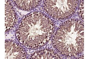 Paraformaldehyde-fixed, paraffin embedded rat testis; Antigen retrieval by boiling in sodium citrate buffer (pH6) for 15min; Block endogenous peroxidase by 3% hydrogen peroxide for 30 minutes; Blocking buffer (normal goat serum) at 37°C for 20min; Antibody incubation with C1orf200 Polyclonal Antibody, Unconjugated (bs-15055R) at 1:400 overnight at 4°C, followed by a conjugated secondary and DAB staining. (C1orf200 antibody  (AA 31-100))
