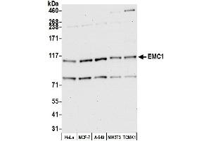 anti-KIAA0090 (KIAA0090) (AA 875-925) antibody