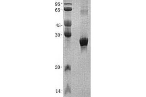 Validation with Western Blot (PMM2 Protein (His tag))