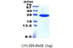 Figure annotation denotes ug of protein loaded and % gel used. (SAR1B Protein)