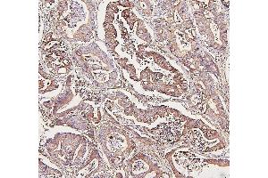 IHC analysis of ALDOA using anti-ALDOA antibody (ABIN7601907). (ALDOA antibody  (AA 50-364))
