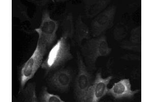 Cyclin B1 staining of U-2 OS (ATCC HTB-96) cells. (Cyclin B1 antibody  (AA 1-21))