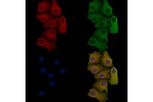 ABIN6256917 and ABIN6275592 staining Hela cells by IF/ICC.