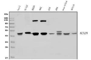 Western blot analysis of Kir6.