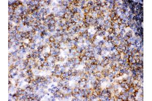 Anti- Lck Picoband antibody, IHC(P) IHC(P): Human Tonsil Tissue (LCK antibody  (C-Term))