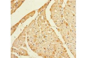 Immunohistochemistry of paraffin-embedded human heart tissue using ABIN7158825 at dilution of 1:100 (Lysozyme-Like 1 antibody  (AA 1-194))