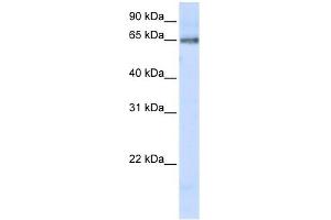 DCLRE1C antibody used at 1 ug/ml to detect target protein. (DCLRE1C antibody)