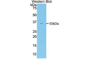 Western Blotting (WB) image for anti-Ectonucleotide Pyrophosphatase/phosphodiesterase 2 (ENPP2) (AA 637-905) antibody (ABIN1858722) (ENPP2 antibody  (AA 637-905))