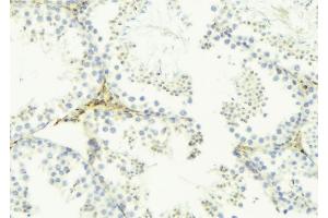 ABIN6276496 at 1/100 staining Mouse testis tissue by IHC-P.