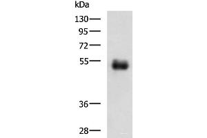Western blot analysis of Human colorectal cancer tissue lysate using METTL17 Polyclonal Antibody at dilution of 1:700 (METTL17 antibody)