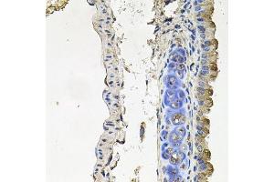 Immunohistochemistry of paraffin-embedded mouse lung using NDUFA6 antibody. (NDUFA6 antibody  (AA 35-154))