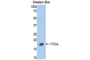 Western blot analysis of the recombinant protein. (CYP2E1 antibody  (AA 379-493))