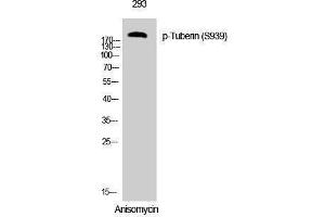 Western Blotting (WB) image for anti-Tuberous Sclerosis 2 (TSC2) (pSer939) antibody (ABIN3182562) (Tuberin antibody  (pSer939))