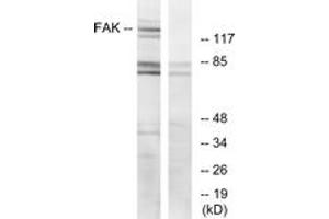 Western blot analysis of extracts from HeLa cells, treated with EGF, using FAK (Ab-925) Antibody. (FAK antibody  (AA 892-941))