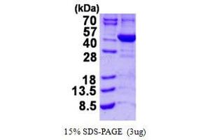 Image no. 1 for Aminolevulinate Dehydratase (ALAD) protein (His tag) (ABIN7279740)