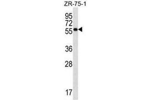 NR1D2 Antibody (Center) western blot analysis in ZR-75-1 cell line lysates (35µg/lane). (NR1D2 antibody  (Middle Region))