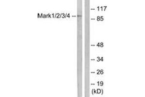 Western blot analysis of extracts from COS7 cells, using MARK1/2/3/4 (Ab-215) Antibody. (MARK1/2/3/4 antibody  (AA 181-230))