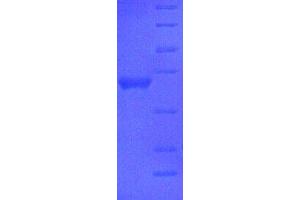 SDS-PAGE (SDS) image for Apolipoprotein A-I (APOA1) (AA 25-265), (full length) protein (His tag) (ABIN7478905) (APOA1 Protein (AA 25-265, full length) (His tag))