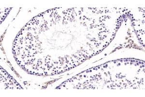 Detection of COL3a1 in Rat Testis Tissue using Monoclonal Antibody to Collagen Type III Alpha 1 (COL3a1) (COL3A1 antibody  (AA 1171-1435))