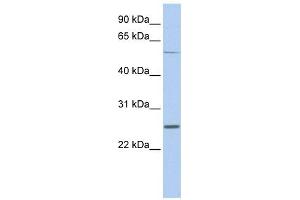 SCN1B antibody used at 1 ug/ml to detect target protein. (SCN1B antibody  (Middle Region))