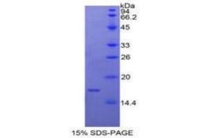 SDS-PAGE of Protein Standard from the Kit (Highly purified E. (Caspase 9 ELISA Kit)