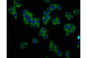 Immunofluorescence staining of HepG2 cells with ABIN7163940 at 1:133, counter-stained with DAPI. (KCNT1 antibody  (AA 1026-1230))