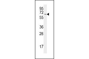 The anti-UBA2 C-term  Antibody (ABIN387913 and ABIN2844315) is used in Western blot to detect UBA2 in Jurkat lysate. (UBA2 antibody  (C-Term))