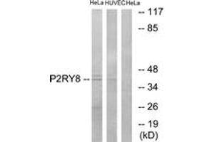 Western Blotting (WB) image for anti-Purinergic Receptor P2Y, G-Protein Coupled, 8 (P2RY8) (AA 192-241) antibody (ABIN2891068) (P2RY8 antibody  (AA 192-241))