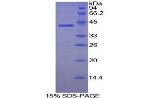 SDS-PAGE (SDS) image for Creatine Kinase, Brain (CKB) (AA 11-367) protein (His tag) (ABIN1079285) (CKB Protein (AA 11-367) (His tag))