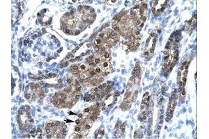 Image no. 1 for anti-Small Nuclear RNA Activating Complex, Polypeptide 2, 45kDa (SNAPC2) (AA 197-246) antibody (ABIN6736271) (SNAPC2 antibody  (AA 197-246))